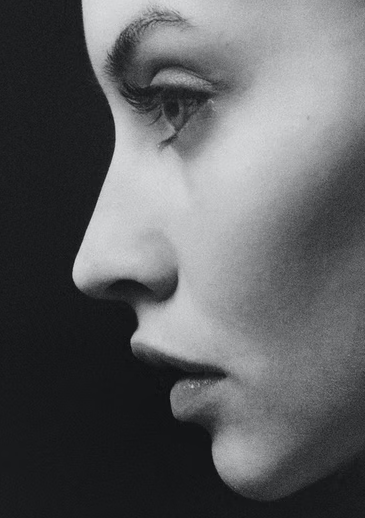 Dermal Fillers