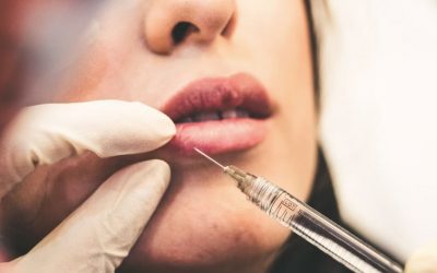 Dermal Fillers vs Hyaluronic Fillers