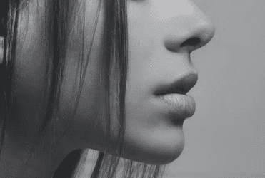 Chin Augmentation with Dermal Filler