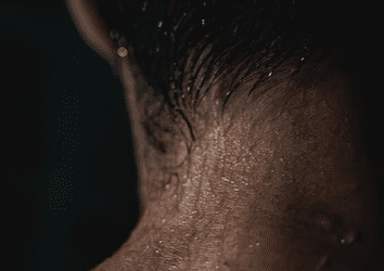 PRP for hair treatment