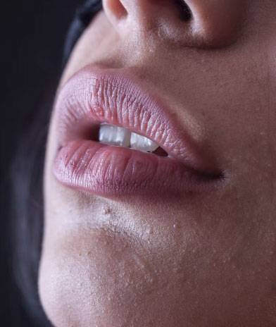 Best lip fillers