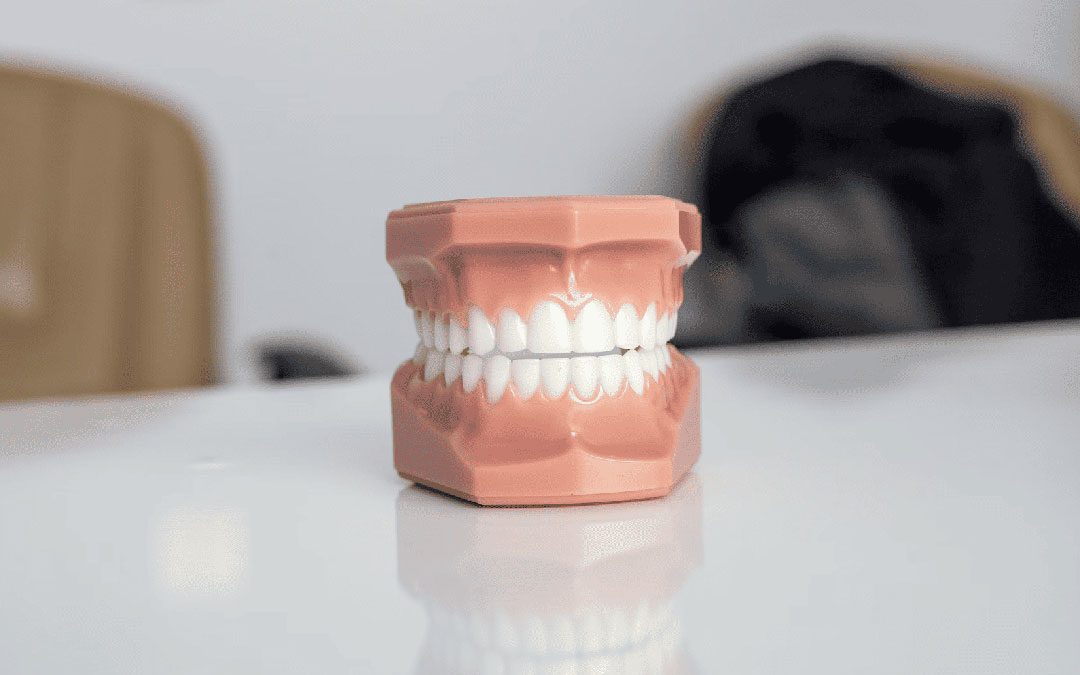How to get rid of a gummy smile with dermal fillers