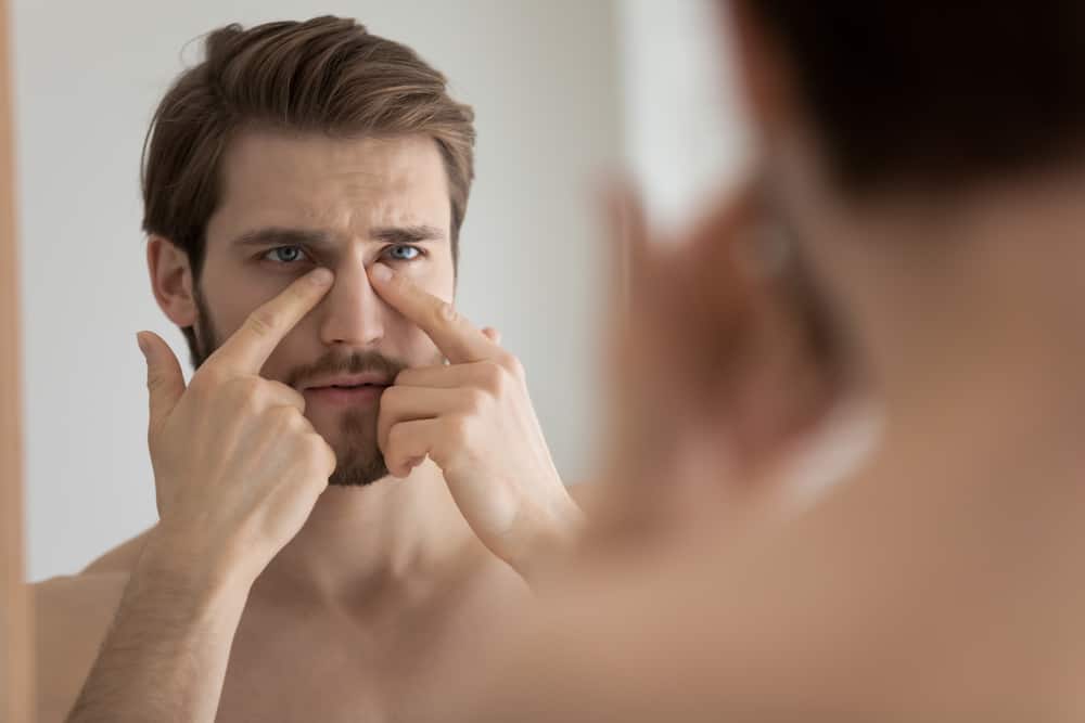Polynucleotides for Dark Circles under eyes