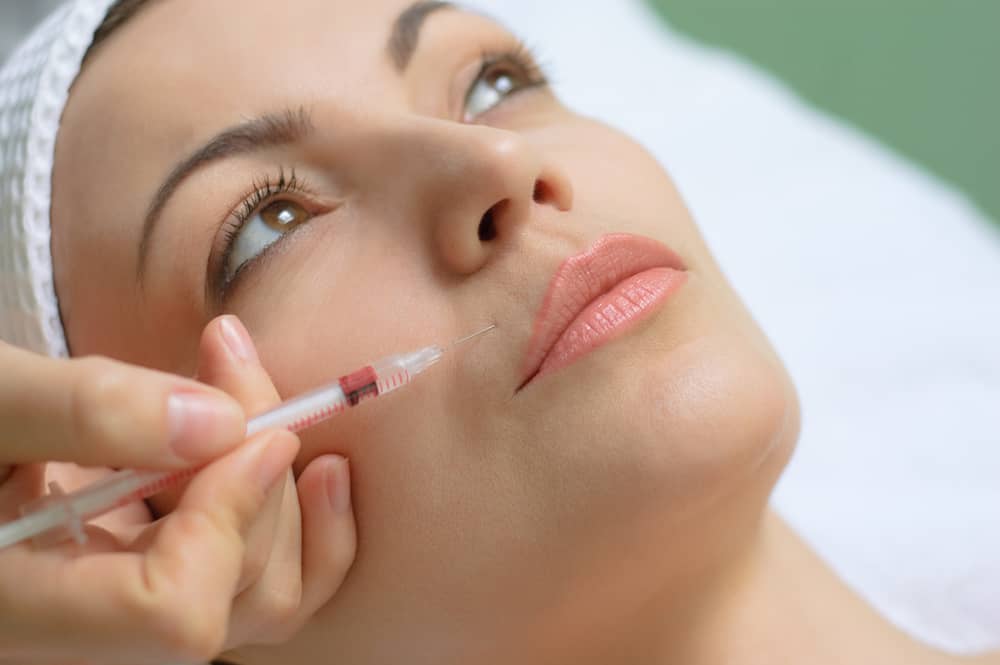 Perioral Lines treatment