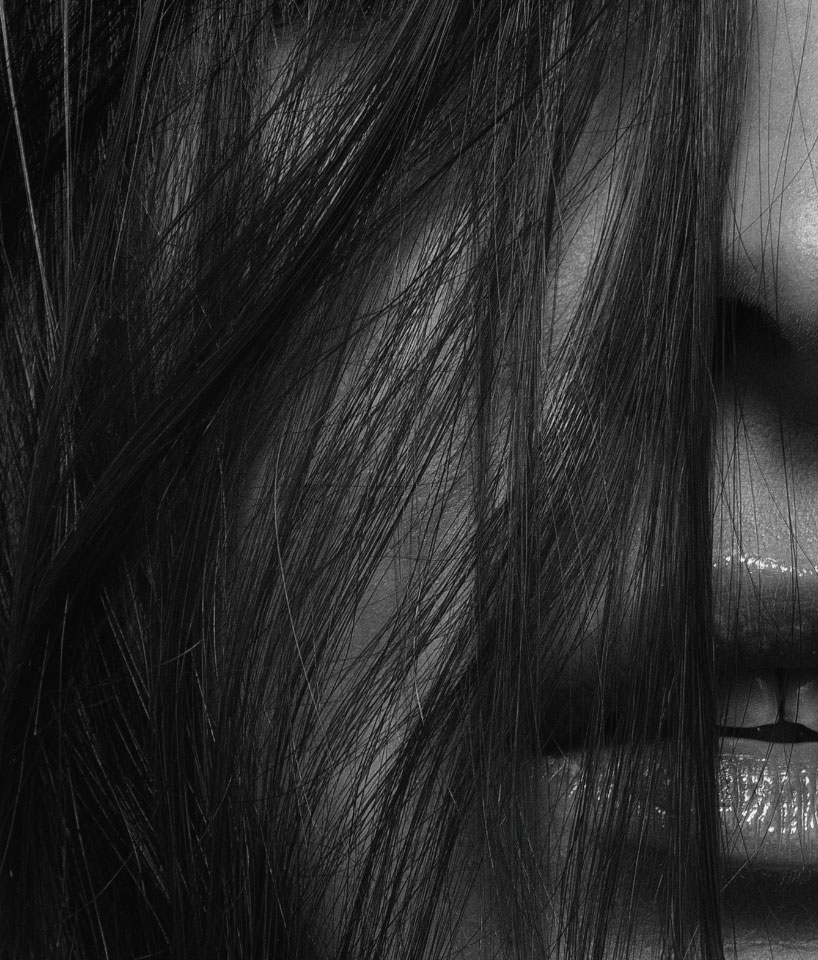 What to Do When Lip Filler Goes Wrong The Guide to Dissolving Lip