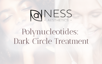 Polynucleotides: Dark Circle Treatment