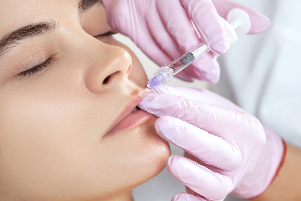 The Secret to Luscious Lips: Hyaluronic Acid Lip Fillers