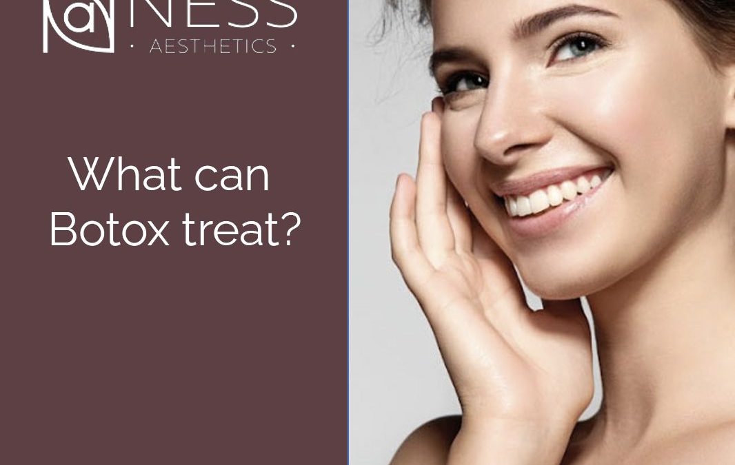 What Can Botox Treat?