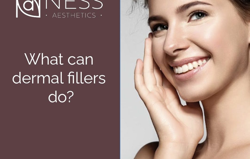 dermal fillers
