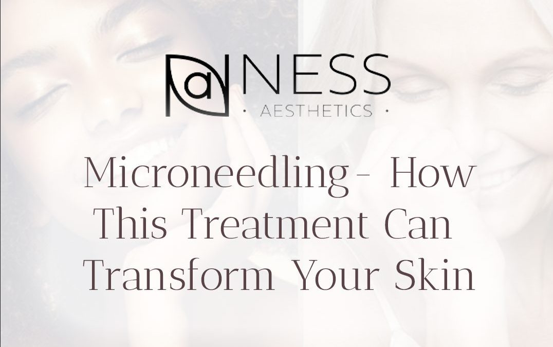 The Rise of Microneedling: How This Treatment Can Transform Your Skin