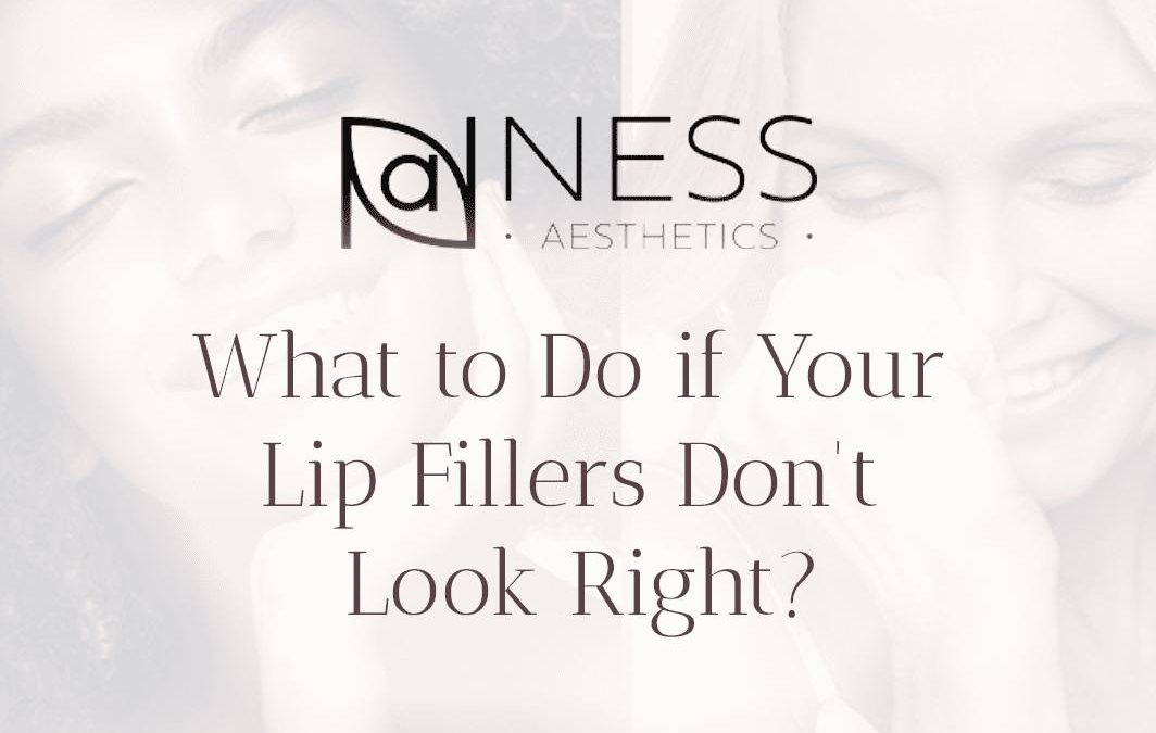 lip fillers don't look right