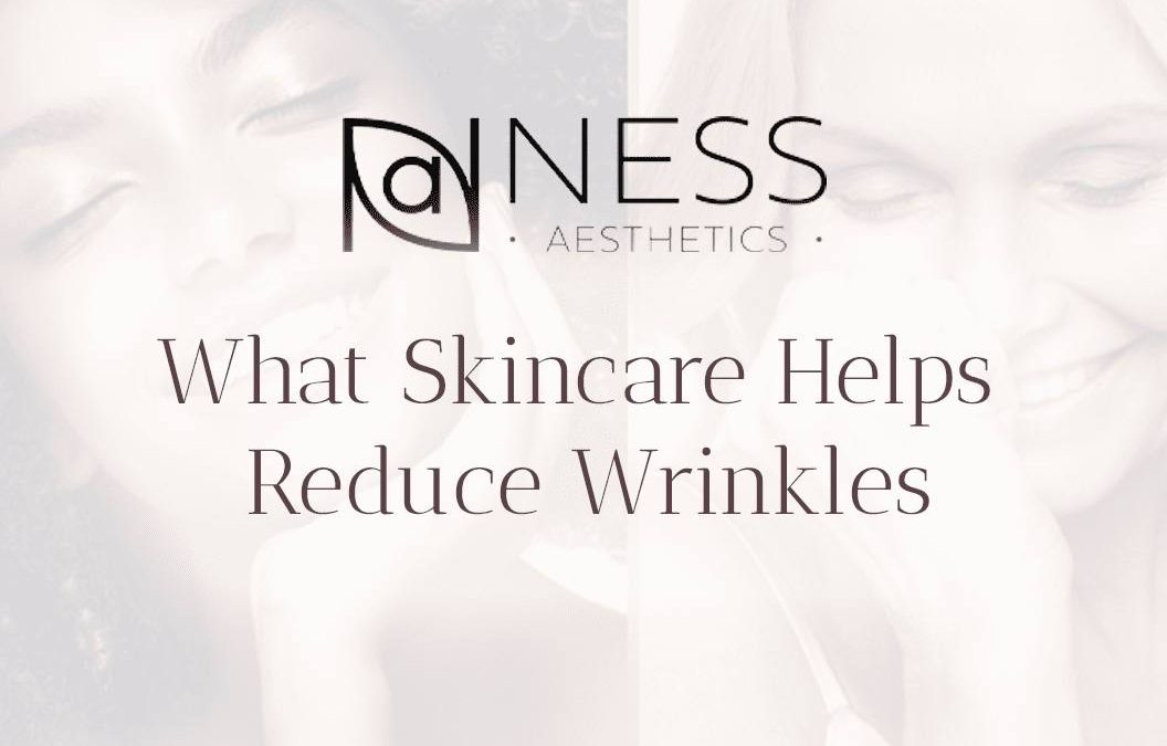 skincare winkles
