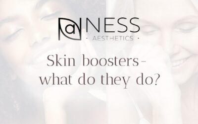Skin boosters- what do they do?
