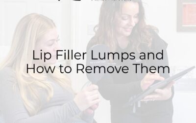Lip Filler Lumps and How to Remove Them