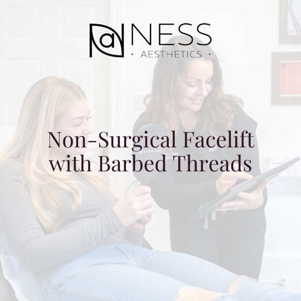 Non-Surgical Facelift with Barbed Threads - Ness Aesthetics