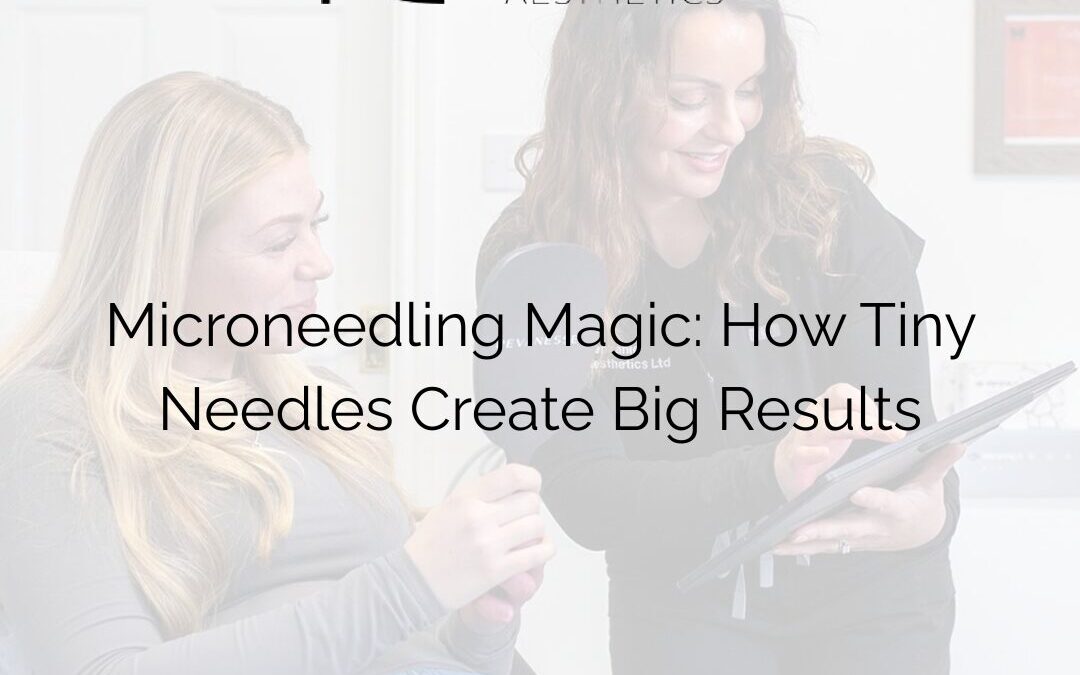 Microneedling Magic: How Tiny Needles Create Big Results