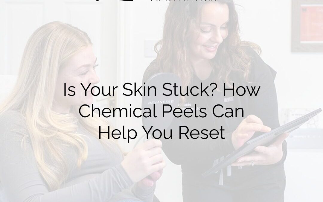 Is Your Skin Stuck? How Chemical Peels Can Help You Reset
