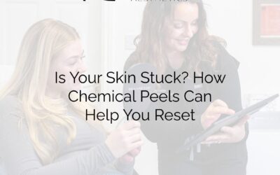 Is Your Skin Stuck? How Chemical Peels Can Help You Reset