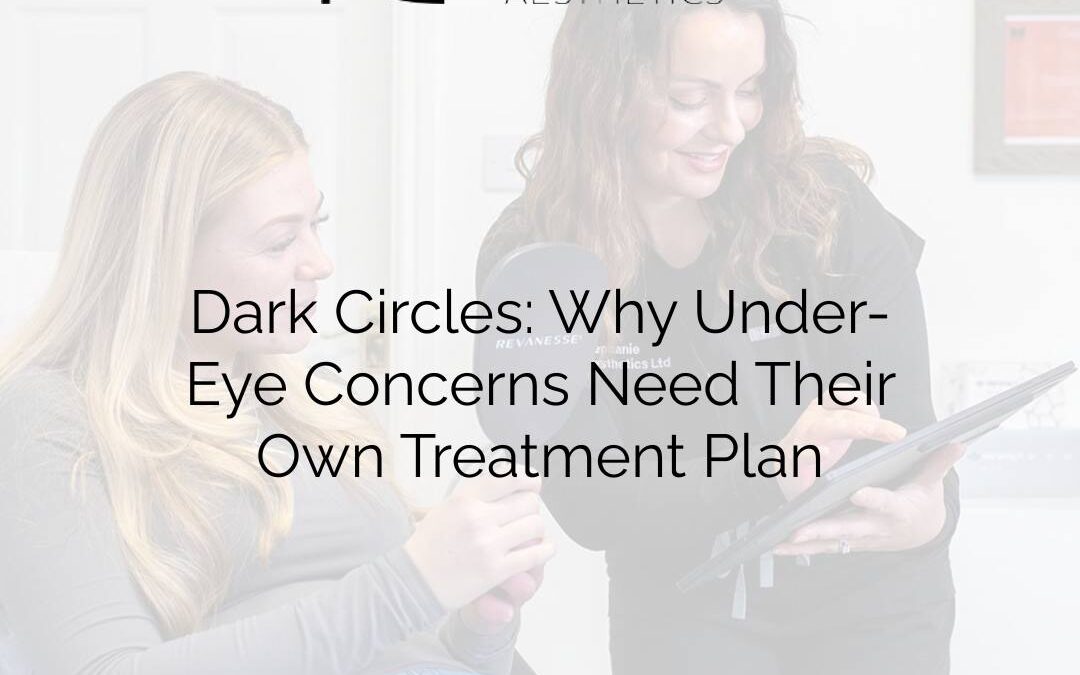 Dark Circles: Why Under-Eye Concerns Need Their Own Treatment Plan