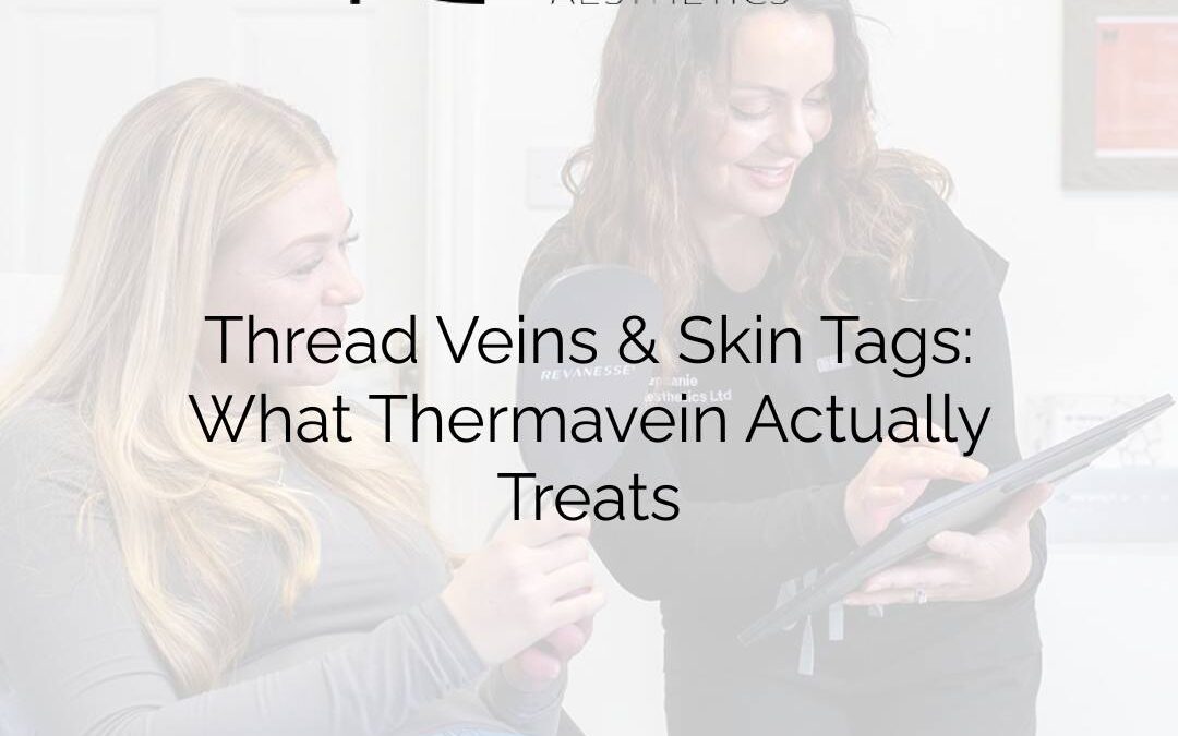 Thread Veins & Skin Tags: What Thermavein Actually Treats